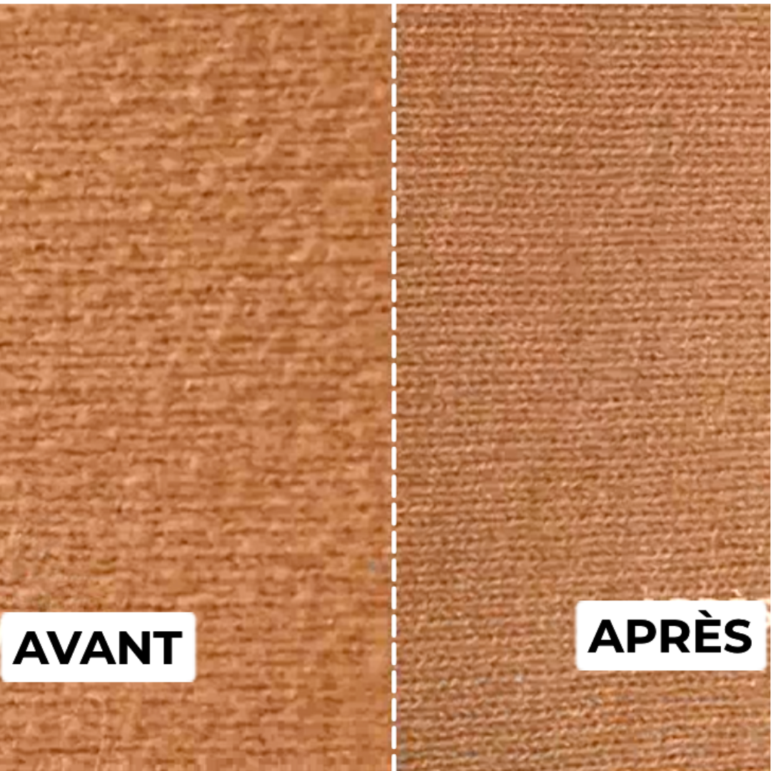 Éliminateur de Peluches - Remover Pro™ 2.0